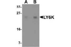 Western blot analysis of LY6K in HeLa cell lysate with LY6K Antibody  at (A) 1 and (B) 2 μg/ml. (Ly6k anticorps  (N-Term))
