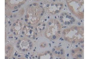 Detection of FGF12 in Human Kidney Tissue using Polyclonal Antibody to Fibroblast Growth Factor 12 (FGF12)