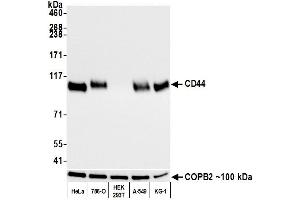 Western Blotting (WB) image for anti-CD44 (CD44) (AA 700-742) antibody (ABIN7454002) (Recombinant CD44 anticorps  (AA 700-742))