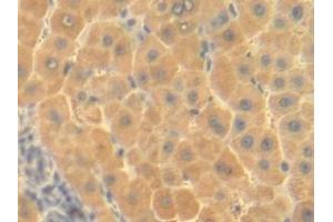 Detection of OTC in Human Liver Tissue using Polyclonal Antibody to Ornithine Transcarbamylase (OTC)