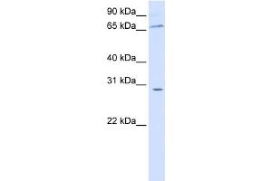 WB Suggested Anti-ZBTB48 Antibody Titration: 0. (ZBTB48 anticorps  (N-Term))