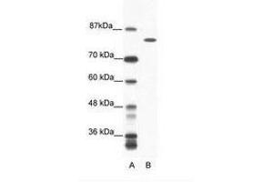 Image no. 1 for anti-DEAH (Asp-Glu-Ala-His) Box Polypeptide 16 (DHX16) (AA 352-401) antibody (ABIN6736054) (DHX16 anticorps  (AA 352-401))