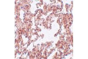 Immunohistochemistry (IHC) image for anti-Sushi-Repeat Containing Protein, X-Linked 2 (SRPX2) (N-Term) antibody (ABIN1031586) (SRPX2 anticorps  (N-Term))