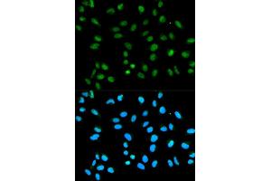 Immunofluorescence analysis of HeLa cell using HNRNPA2B1 antibody. (HNRNPA2B1 anticorps  (AA 1-180))