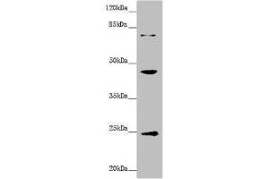 Western blot All lanes: GNA15 antibody at 1. (GNA15 anticorps  (AA 1-374))