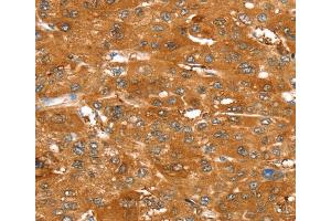 Immunohistochemistry (IHC) image for anti-ATP-Binding Cassette, Sub-Family C (CFTR/MRP), Member 9 (ABCC9) antibody (ABIN2433955) (ABCC9 anticorps)