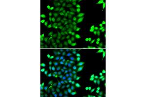 Immunofluorescence analysis of MCF-7 cells using RNF7 antibody (ABIN4905022). (RNF7 anticorps)