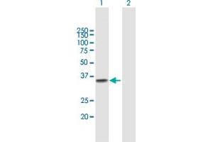 Western Blot analysis of TREX1 expression in transfected 293T cell line by TREX1 MaxPab polyclonal antibody. (TREX1 anticorps  (AA 1-304))