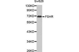 Western blot analysis of extracts of Sw626 cell line,using FSHR antibody. (FSHR anticorps)