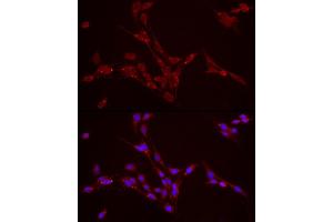 Immunofluorescence analysis of PC-12 cells using Perilipin-2 Rabbit pAb (ABIN6127414, ABIN6145773, ABIN6145774 and ABIN6221871) at dilution of 1:50 (40x lens).