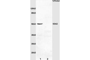 L1 rat kidney lysates L2 mouse colon carcinoma lysates probed with Anti IL-2R gamma/CD132 Polyclonal Antibody, Unconjugated (ABIN731993) at 1:200 overnight at 4 °C.