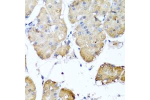 Immunohistochemistry of paraffin-embedded human stomach using NIN antibody (ABIN5974918) at dilution of 1/100 (40x lens). (Ninein anticorps)