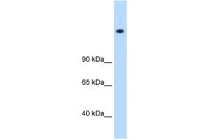 WB Suggested Anti-MED16 Antibody Titration: 0.