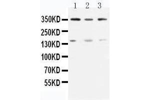 Anti-ATM antibody, Western blotting Lane 1: Rat Testis Tissue Lysate Lane 2: U87 Cell Lysate Lane 3: MCF-7 Cell Lysate (ATM anticorps  (N-Term))