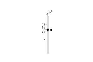 All lanes : Anti-TRBC1 Antibody (Center) at 1:500 dilution Lane 1: Molt-4 whole cell lysate Lysates/proteins at 20 μg per lane. (TRBC1 anticorps  (AA 104-136))