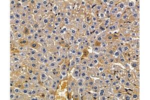 anti-F-Box Protein 42 (FBXO42) antibody