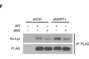 SIRT1 deacetylates KAP1 in vitro and in vivo.