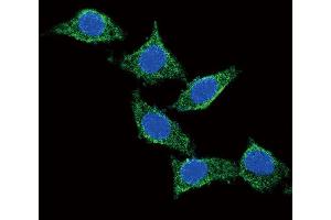 Confocal immunofluorescent analysis of ADCY Antibody (C-term) (ABIN651855 and ABIN2840424) with 293 cell followed by Alexa Fluor?