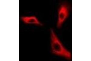 Immunofluorescent analysis of H6PD staining in A549 cells.