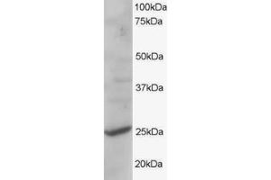 ABIN184844 staining (1µg/ml) of human liver lysate (RIPA buffer, 35µg total protein per lane). (CYB561D2 anticorps  (C-Term))