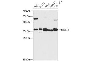 Western blot analysis of extracts of various cell lines, using NOL12 antibody  at 1:3000 dilution.
