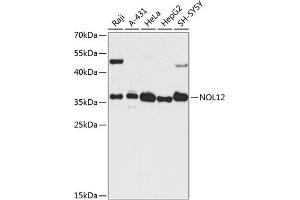 Western blot analysis of extracts of various cell lines, using NOL12 antibody  at 1:3000 dilution. (NOL12 anticorps  (AA 1-213))