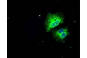 Image no. 2 for anti-Solute Carrier Family 7 (Amino Acid Transporter, L-Type), Member 8 (SLC7A8) antibody (ABIN1500960)