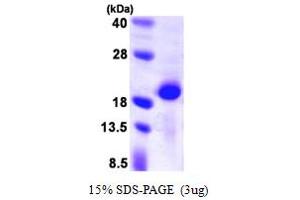 SDS-PAGE (SDS) image for Calcineurin B (CAN) (AA 1-173) protein (His tag) (ABIN667404)