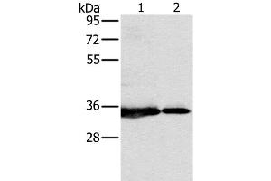 Western Blot analysis of 231 and Jurkat cell using NDUFAF1 Polyclonal Antibody at dilution of 1:500 (NDUFAF1 anticorps)