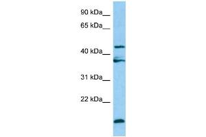 WB Suggested Anti-LGMN Antibody Titration: 1. (LGMN anticorps  (Middle Region))
