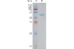 Human Protein, hFc Tag on SDS-PAGE under reducing condition.