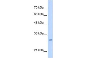 Western Blotting (WB) image for anti-Myeloid Leukemia Factor 2 (MLF2) antibody (ABIN2462989) (MLF2 anticorps)