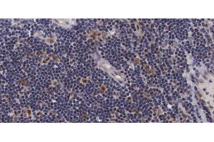 ABIN6267686 at 1/100 staining human Lymph node tissue sections by IHC-P. (ASK1 anticorps  (pSer966))