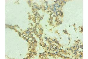 Immunohistochemical of paraffin-embedded human lung tissue using ABIN7168560 at dilution of 1:200 (S1A9 anticorps)