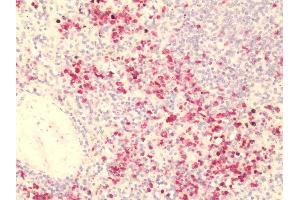 Human, Spleen: Formalin-Fixed Paraffin-Embedded (FFPE)