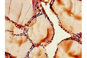 IHC image of ABIN7153197 diluted at 1:500 and staining in paraffin-embedded human thyroid tissue performed on a Leica BondTM system.