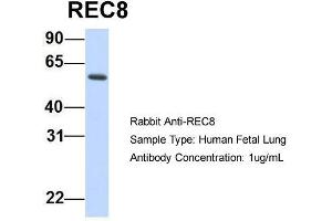 Host:  Rabbit  Target Name:  REC8  Sample Type:  Human Fetal Lung  Antibody Dilution:  1. (REC8 anticorps  (N-Term))