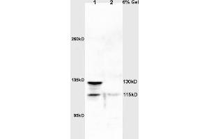 Lane 1: rat lung lysates Lane 2: rat brain lysates probed with Anti NOS-2/iNOS Polyclonal Antibody, Unconjugated (ABIN725675) at 1:200 in 4 °C. (NOS2 anticorps)