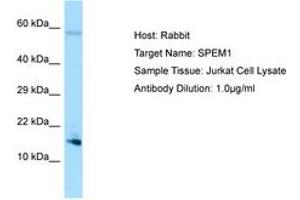 Image no. 1 for anti-Spermatid Maturation 1 (SPEM1) (AA 72-121) antibody (ABIN6750075) (SPEM1 anticorps  (AA 72-121))