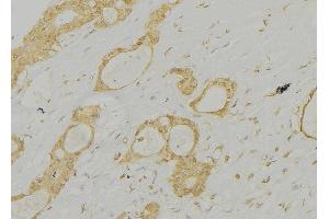 ABIN6277313 at 1/100 staining Human lung tissue by IHC-P. (Cathepsin E anticorps  (Internal Region))
