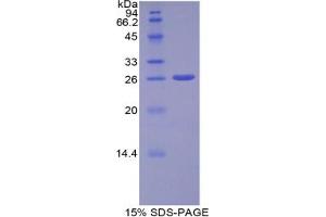 SDS-PAGE analysis of Human ADAM10 Protein. (ADAM10 Protéine)