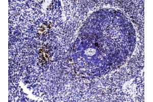 IHC analysis of Caspase8 using anti-Caspase8 antibody .