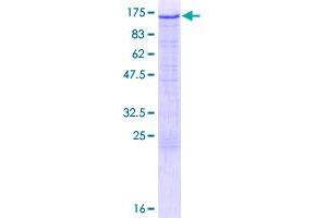 Image no. 1 for Hexokinase 2 (HK2) (AA 1-917) protein (GST tag) (ABIN1306727)
