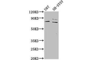 Western Blot Positive WB detected in: U87 whole cell lysate, SH-SY5Y whole cell lysate All lanes: TIPARP antibody at 4. (Tiparp anticorps  (AA 74-178))