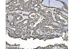 IHC analysis of P4HB using anti-P4HB antibody (ABIN7600075). (P4HB anticorps  (AA 146-363))