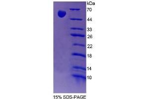 SDS-PAGE analysis of Rat FARS2 Protein. (FARS2 Protéine)