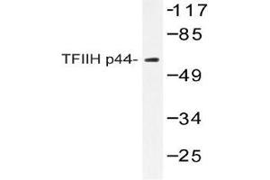 Western blot (WB) analysis of TFIIH p44 antibody in extracts from COLO205 (GTF2H2 anticorps)