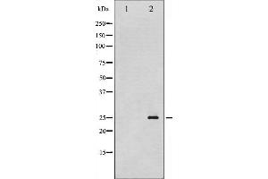 Western blot analysis of p21 Cip1 phosphorylation expression in EGF treated HeLa whole cell lysates,The lane on the left is treated with the antigen-specific peptide.