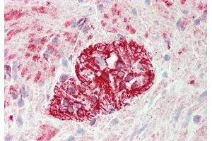 Rabbit Anti-KLHL25 antibody  Formalin Fixed Paraffin Embedded Tissue: Human Colon, Myenteric Plexus Primary antibody Concentration: 1:100 Secondary Antibody: Donkey anti-Rabbit-Cy3 Secondary Antibody Concentration: 1:200 Magnification: 20x Exposure Time: 0. (KLHL25 anticorps  (N-Term))