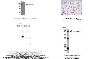 Image no. 1 for anti-Hypoxia Inducible Factor 1, alpha Subunit (Basic Helix-Loop-Helix Transcription Factor) (HIF1A) (AA 432-528) antibody (ABIN363203) (HIF1A anticorps  (AA 432-528))